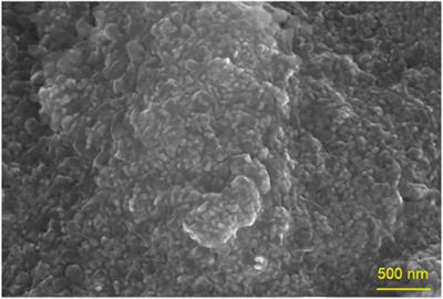 Iron Oxide Nanoparticles Synthesis From Vermicomposting Leachate and its Antioxidant Activities